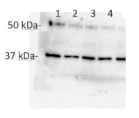 AOX2 | Plant alternative oxidase 2 in the group Antibodies Plant/Algal  / Mitochondria | Respiration at Agrisera AB (Antibodies for research) (AS21 4532)